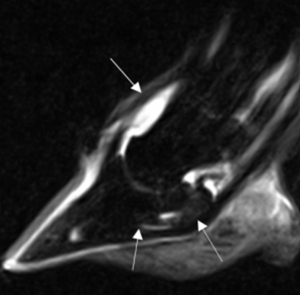 Badanie rezonansem magnetycznym (MRI).